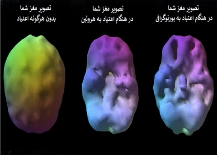 اثر پورنوگرافی بر مغز چگونه است؟